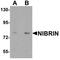 Nibrin antibody, TA326621, Origene, Western Blot image 