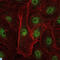 REL Proto-Oncogene, NF-KB Subunit antibody, LS-C814010, Lifespan Biosciences, Immunohistochemistry paraffin image 
