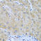 Furin, Paired Basic Amino Acid Cleaving Enzyme antibody, LS-C349148, Lifespan Biosciences, Immunohistochemistry frozen image 
