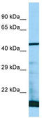Proteasomal ATPase Associated Factor 1 antibody, TA333657, Origene, Western Blot image 