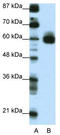 Recepin antibody, TA343489, Origene, Western Blot image 