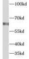 Galactosidase Beta 1 antibody, FNab00877, FineTest, Western Blot image 