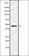 S-Antigen Visual Arrestin antibody, orb337715, Biorbyt, Western Blot image 