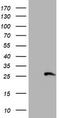 Regulatory Factor X Associated Ankyrin Containing Protein antibody, TA504278, Origene, Western Blot image 