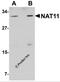 NAA40 antibody, 5549, ProSci Inc, Western Blot image 