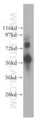 YY1 Associated Protein 1 antibody, 10425-1-AP, Proteintech Group, Western Blot image 