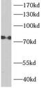 Acyl-CoA Synthetase Long Chain Family Member 1 antibody, FNab00106, FineTest, Western Blot image 