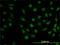 Dihydrofolate Reductase antibody, H00001719-M01, Novus Biologicals, Immunocytochemistry image 
