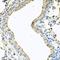 Coiled-Coil-Helix-Coiled-Coil-Helix Domain Containing 3 antibody, orb374209, Biorbyt, Immunohistochemistry paraffin image 