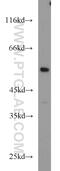 Nuclear Receptor Subfamily 5 Group A Member 1 antibody, 18658-1-AP, Proteintech Group, Western Blot image 