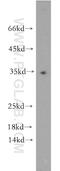Nicotinamide mononucleotide adenylyltransferase 1 antibody, 11399-1-AP, Proteintech Group, Western Blot image 