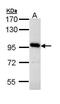 ATPase H+ Transporting V0 Subunit A4 antibody, GTX111243, GeneTex, Western Blot image 