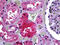 Galactose-1-phosphate uridylyltransferase antibody, 51-706, ProSci, Immunohistochemistry paraffin image 