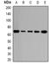 Polypeptide N-Acetylgalactosaminyltransferase 2 antibody, orb341194, Biorbyt, Western Blot image 