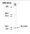 Cytochrome P450 Family 26 Subfamily A Member 1 antibody, TA353120L, Origene, Western Blot image 