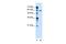 Zinc Finger DHHC-Type Containing 13 antibody, PA5-42565, Invitrogen Antibodies, Western Blot image 