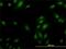 60S ribosomal protein L9 antibody, H00006133-M01, Novus Biologicals, Immunocytochemistry image 