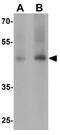 Growth Differentiation Factor 1 antibody, GTX17181, GeneTex, Western Blot image 
