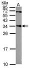 Centromere Protein P antibody, PA5-31186, Invitrogen Antibodies, Western Blot image 