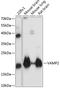 Vesicle Associated Membrane Protein 2 antibody, A02331-1, Boster Biological Technology, Western Blot image 