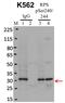 Ribosomal Protein S6 antibody, 701845, Invitrogen Antibodies, Immunoprecipitation image 
