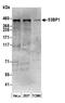 p53BP1 antibody, A300-273A, Bethyl Labs, Western Blot image 