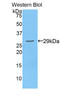 PBC antibody, LS-C293689, Lifespan Biosciences, Western Blot image 