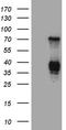 Ribonuclease A Family Member 11 (Inactive) antibody, TA810554S, Origene, Western Blot image 