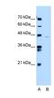 Ankyrin Repeat Domain 65 antibody, NBP1-91321, Novus Biologicals, Western Blot image 