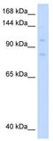 DNA replication licensing factor MCM8 antibody, TA341696, Origene, Western Blot image 