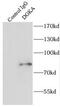 Diacylglycerol Kinase Alpha antibody, FNab02356, FineTest, Immunoprecipitation image 