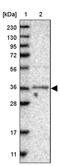 TRNA Methyltransferase O antibody, PA5-54368, Invitrogen Antibodies, Western Blot image 