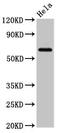Solute Carrier Family 22 Member 25 antibody, CSB-PA740875LA01HU, Cusabio, Western Blot image 