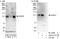 Arf-GAP with SH3 domain, ANK repeat and PH domain-containing protein 2 antibody, A303-311A, Bethyl Labs, Western Blot image 