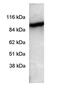 Phosphodiesterase 6A antibody, GTX25659, GeneTex, Western Blot image 