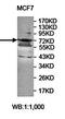 Zinc Finger Protein 418 antibody, orb78092, Biorbyt, Western Blot image 