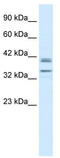 One Cut Homeobox 3 antibody, TA335321, Origene, Western Blot image 