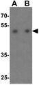 Histone Deacetylase 2 antibody, GTX31925, GeneTex, Western Blot image 