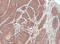 Fibroblast growth factor receptor-like 1 antibody, LS-C185563, Lifespan Biosciences, Immunohistochemistry paraffin image 