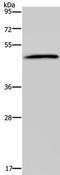5-Hydroxytryptamine Receptor 2B antibody, TA321222, Origene, Western Blot image 