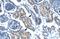 Forkhead Box F1 antibody, PA5-40516, Invitrogen Antibodies, Immunohistochemistry frozen image 