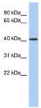 Ceramide Synthase 5 antibody, TA341466, Origene, Western Blot image 