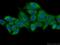 N(Alpha)-Acetyltransferase 15, NatA Auxiliary Subunit antibody, 23845-1-AP, Proteintech Group, Immunofluorescence image 