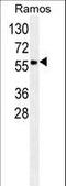 Serpin Family A Member 9 antibody, LS-C161416, Lifespan Biosciences, Western Blot image 