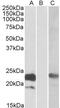 Cystatin-8 antibody, GTX88202, GeneTex, Western Blot image 