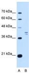 PSAT1 antibody, TA339354, Origene, Western Blot image 