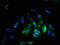 Solute Carrier Family 38 Member 5 antibody, LS-C378402, Lifespan Biosciences, Immunofluorescence image 