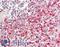Polycomb protein SUZ12 antibody, LS-B10727, Lifespan Biosciences, Immunohistochemistry frozen image 