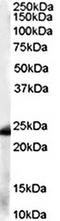 Nanos C2HC-Type Zinc Finger 1 antibody, orb19035, Biorbyt, Western Blot image 