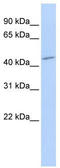 Phosphatidylcholine:ceramide cholinephosphotransferase 1 antibody, TA329765, Origene, Western Blot image 